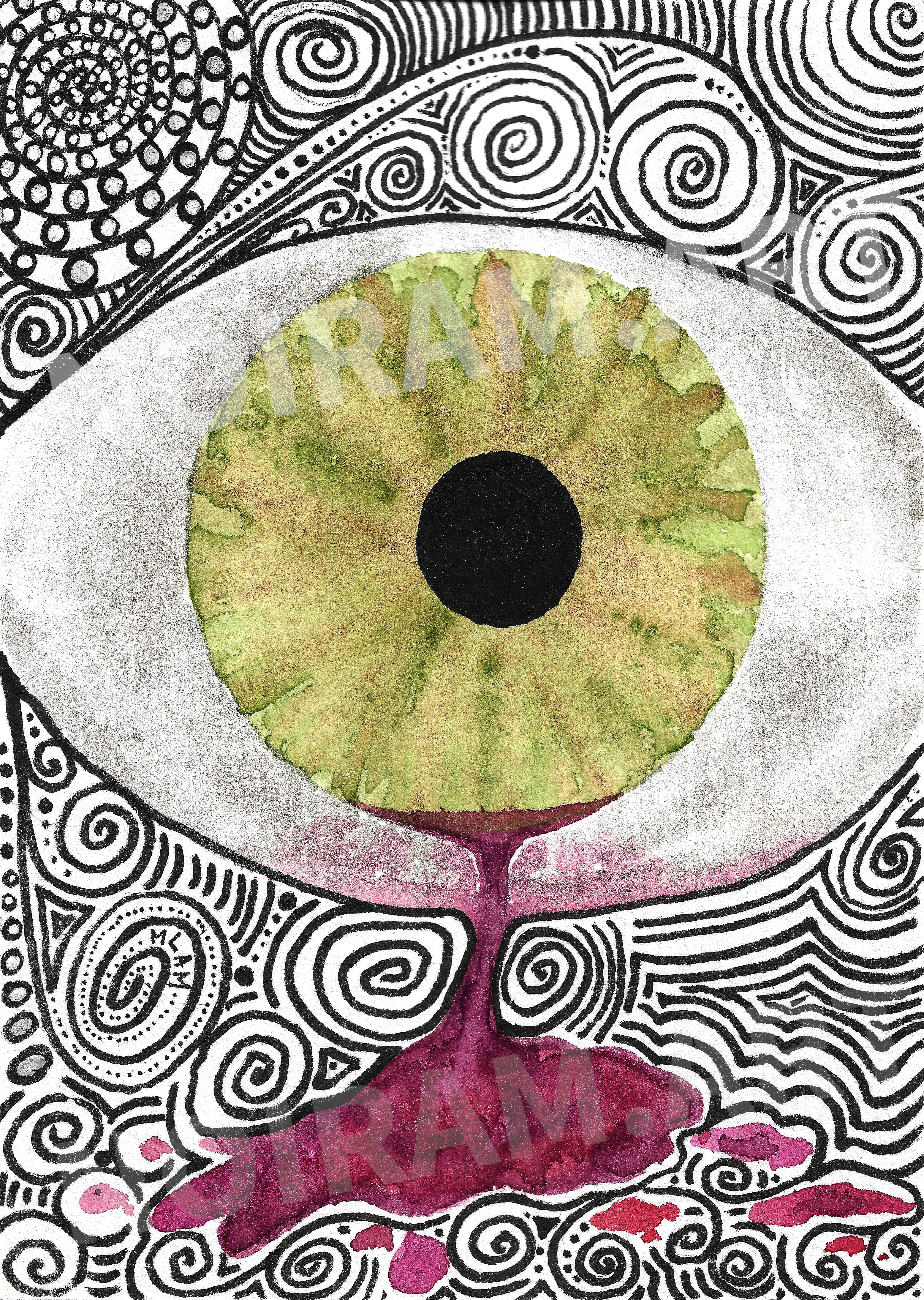 Aquarelle noiram mlam poncet oeil sang opération